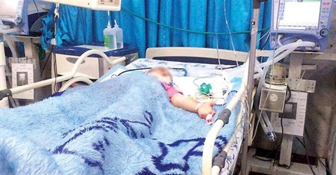 سوختگی کودک سه ساله اهوازی در اتاق عمل/ مقصران حادثه شناسایی شدند