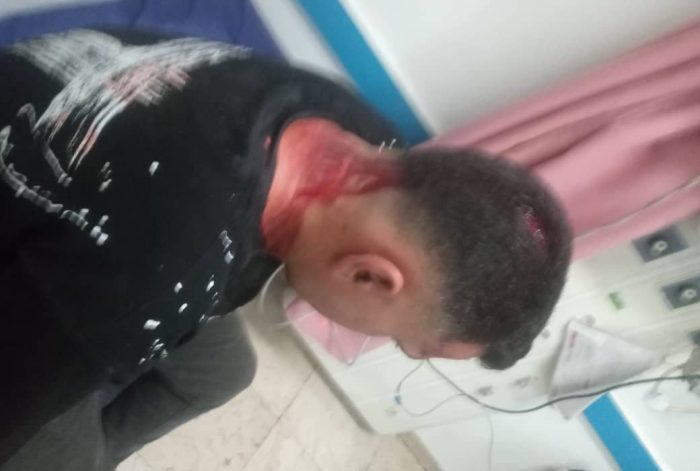 مصدومیت نیروی اجرایی شهرداری مسجدسلیمان در عملیات جمع آوری سد معبر+تصاویر